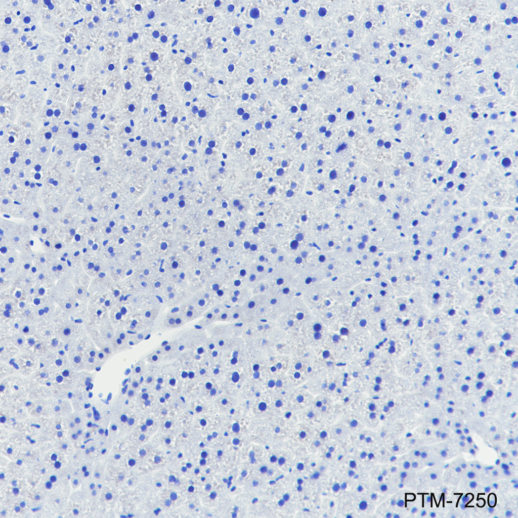 Anti-AMPA Receptor 1 / GluA1 Rabbit mAb