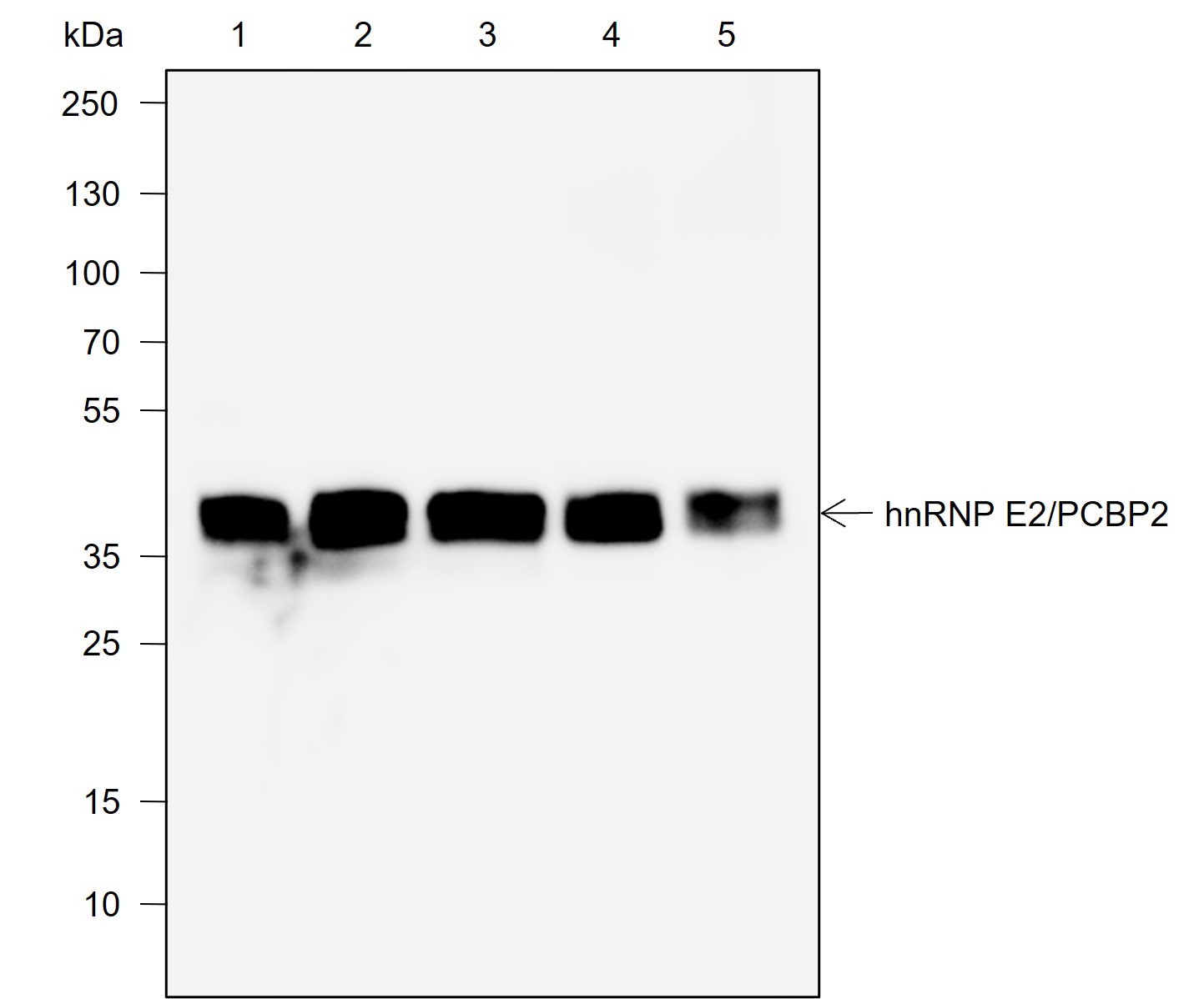 Anti-hnRNP E2 / PCBP2 Rabbit mAb