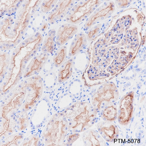 Anti-CD10 Rabbit mAb