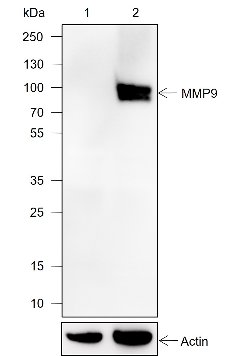 Anti-MMP9 Rabbit mAb