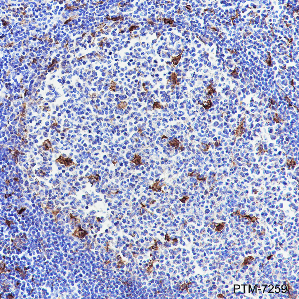 Anti-MMP9 Rabbit mAb
