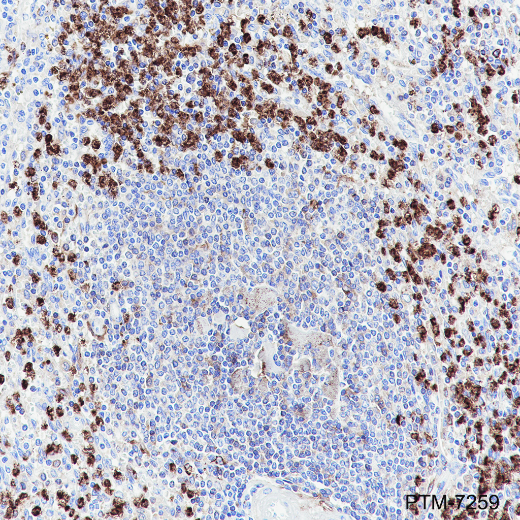 Anti-MMP9 Rabbit mAb