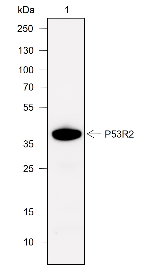 Anti-p53R2 Rabbit mAb
