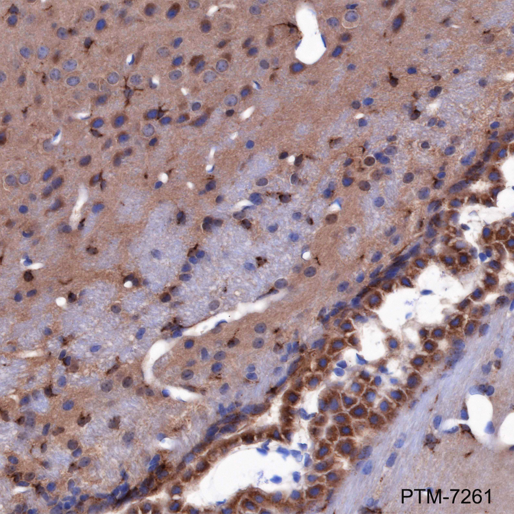 Anti-Clusterin alpha Chain Rabbit mAb