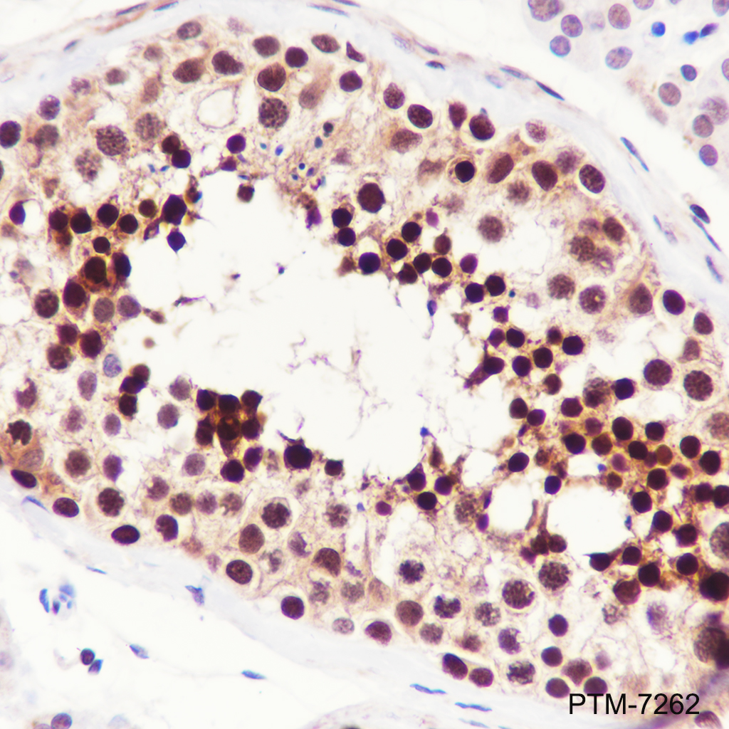 Anti-DNA Polymerase beta Rabbit mAb
