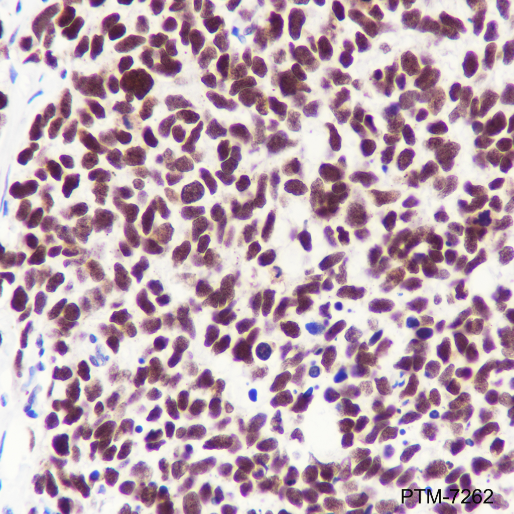 Anti-DNA Polymerase beta Rabbit mAb