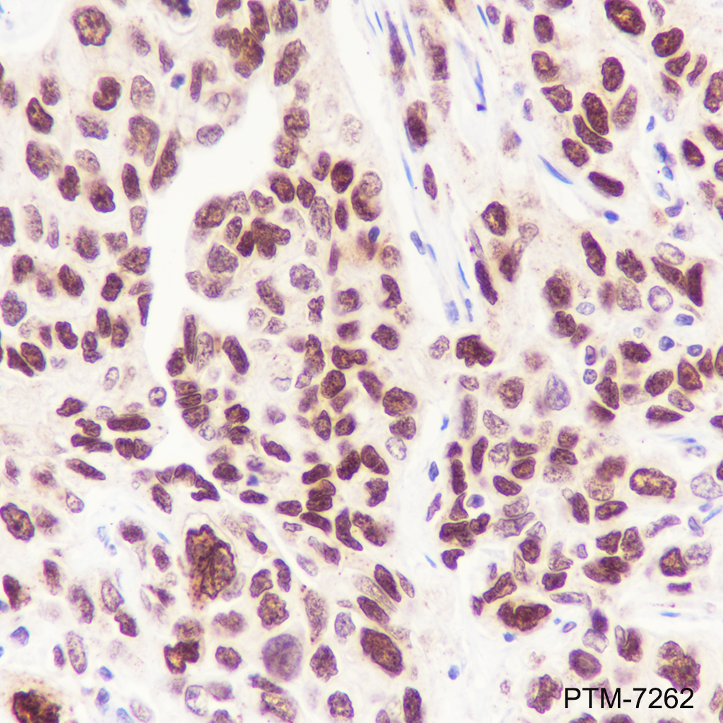 Anti-DNA Polymerase beta Rabbit mAb