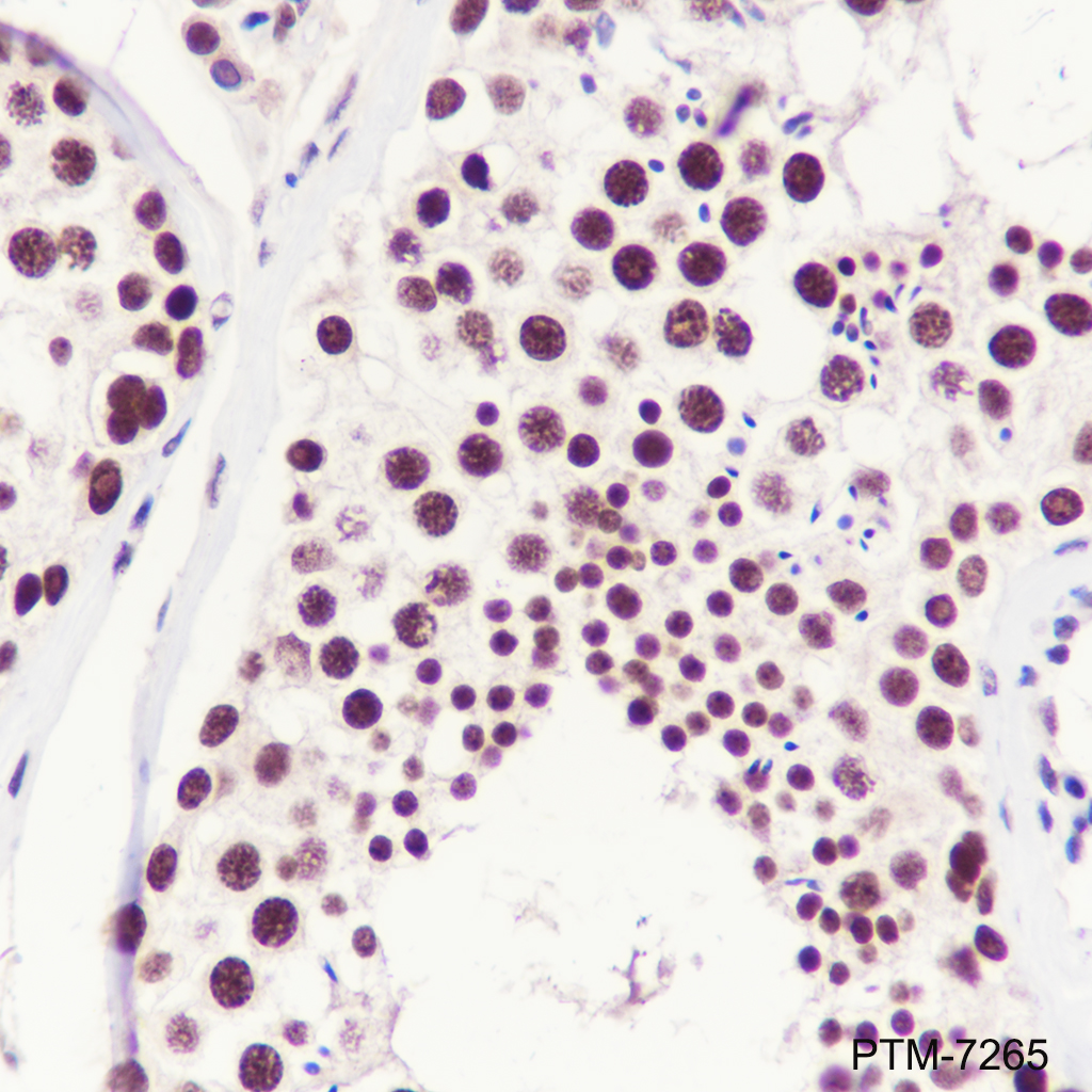 Anti-USP39 Rabbit mAb
