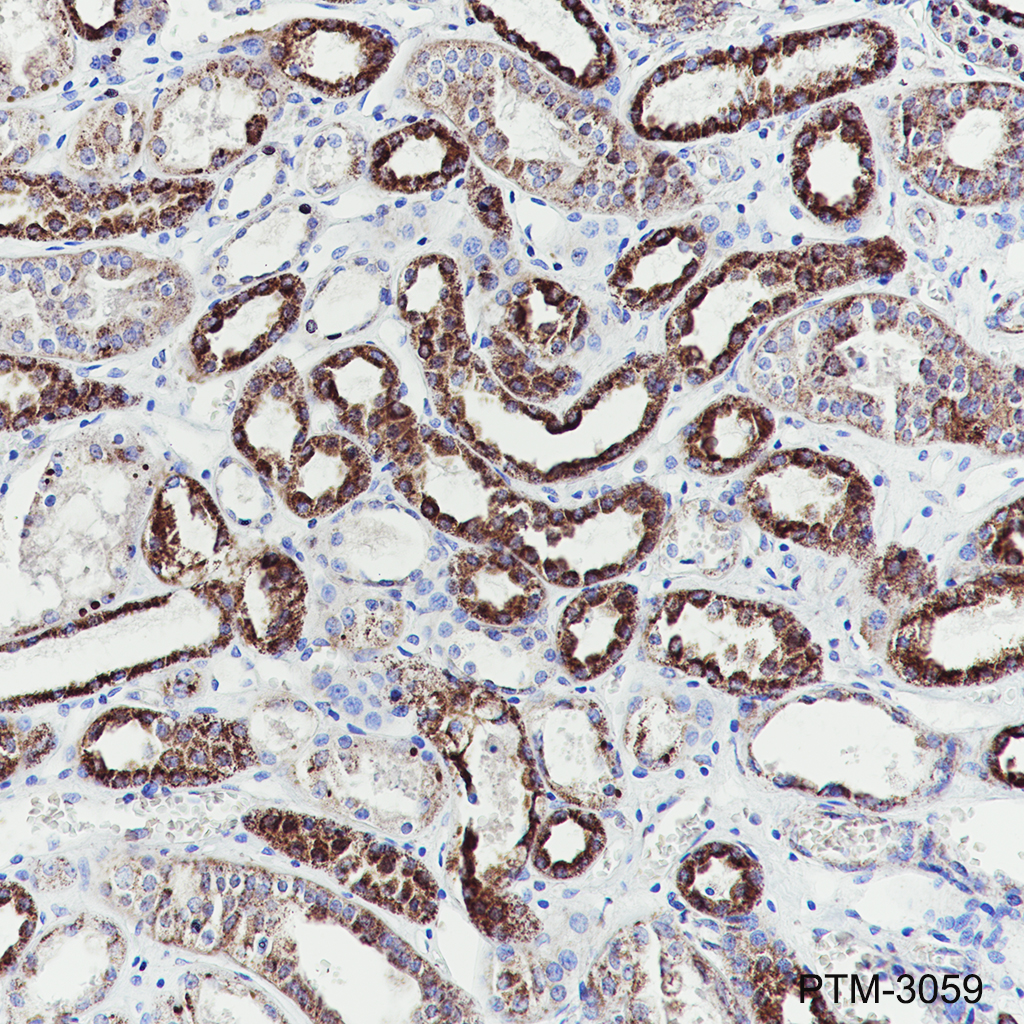 Anti-SUCLG1 Rabbit mAb