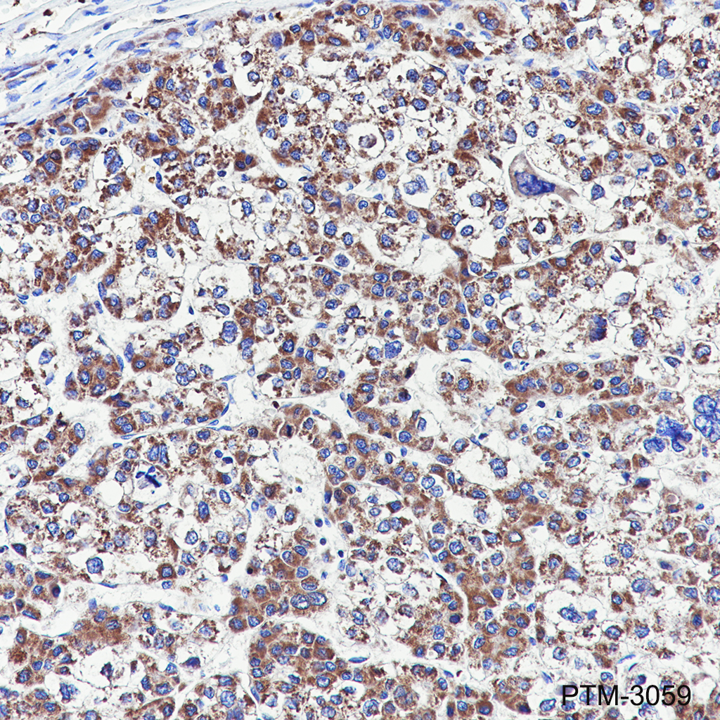 Anti-SUCLG1 Rabbit mAb