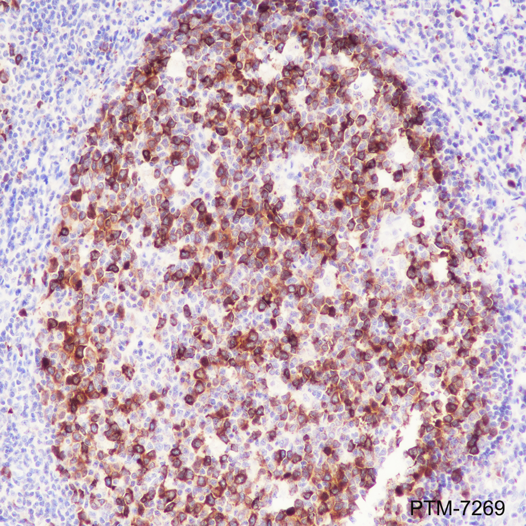 Anti-TACC3 Rabbit mAb