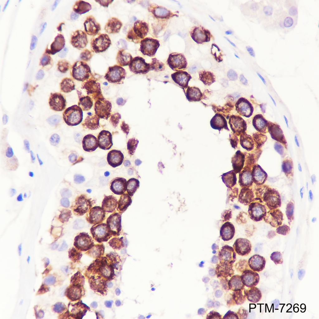 Anti-TACC3 Rabbit mAb