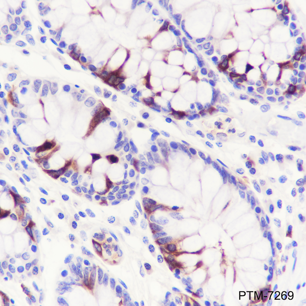 Anti-TACC3 Rabbit mAb