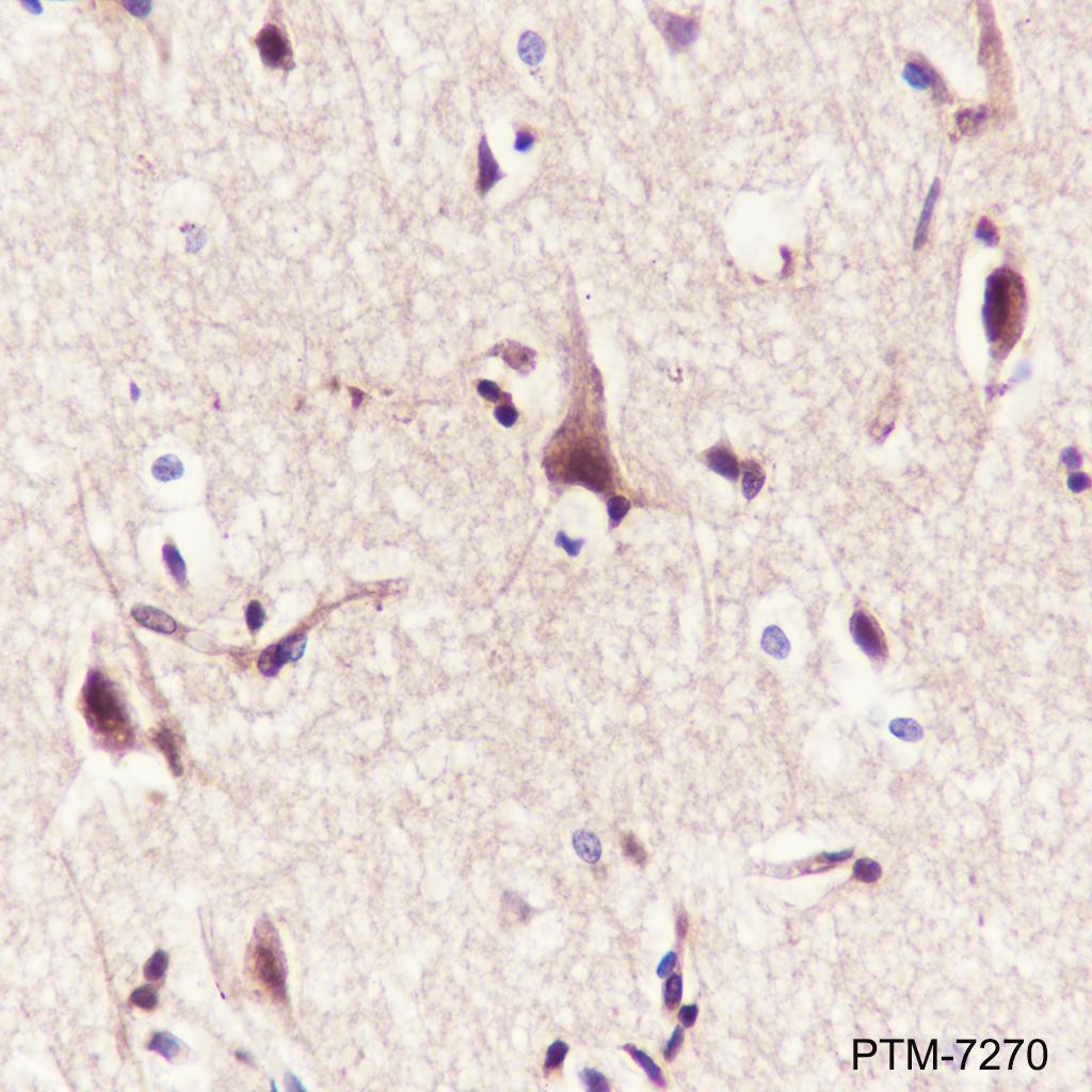 Anti-UBXN1 Rabbit mAb