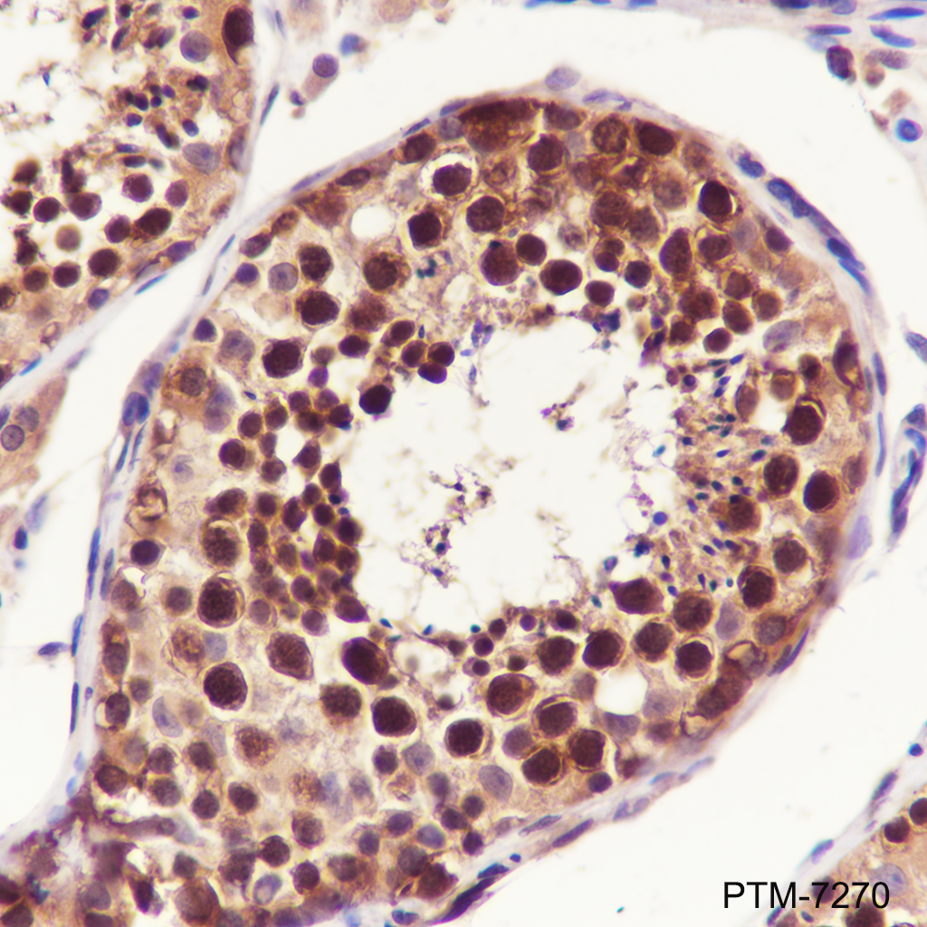 Anti-UBXN1 Rabbit mAb