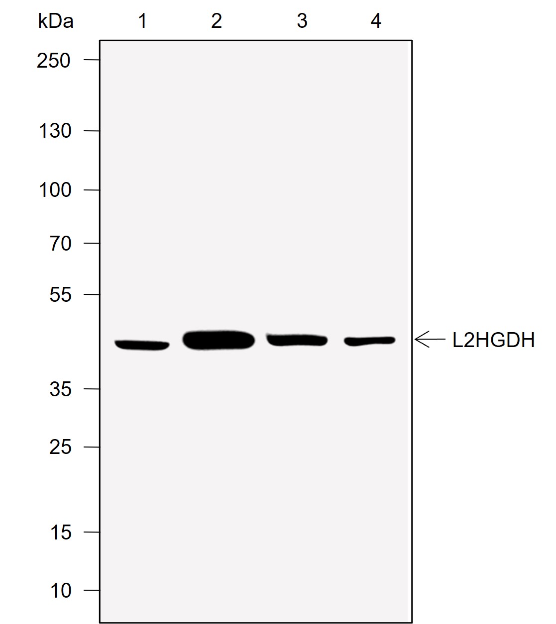 Anti-L2HGDH Mouse mAb