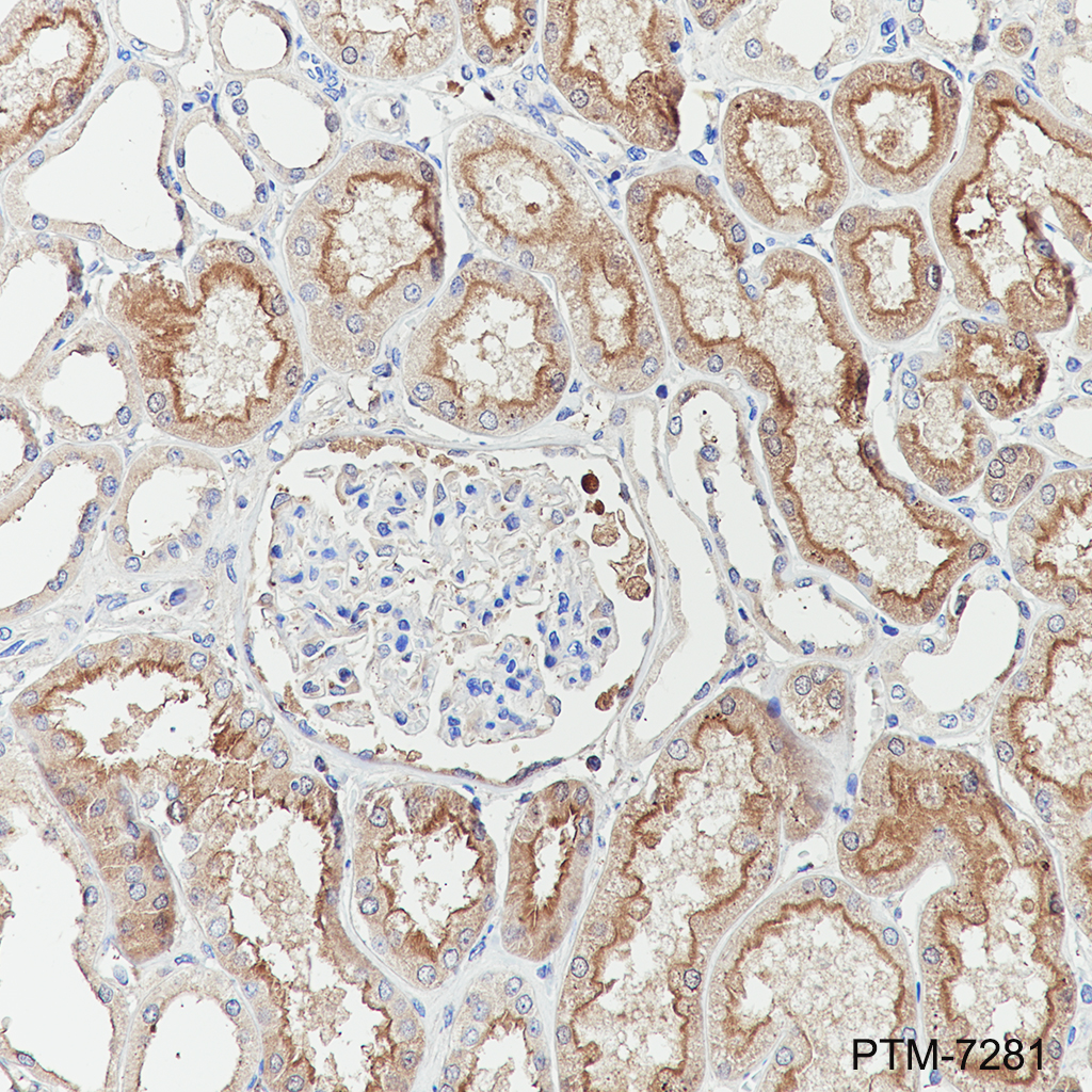 Anti-EAAT3 Rabbit mAb