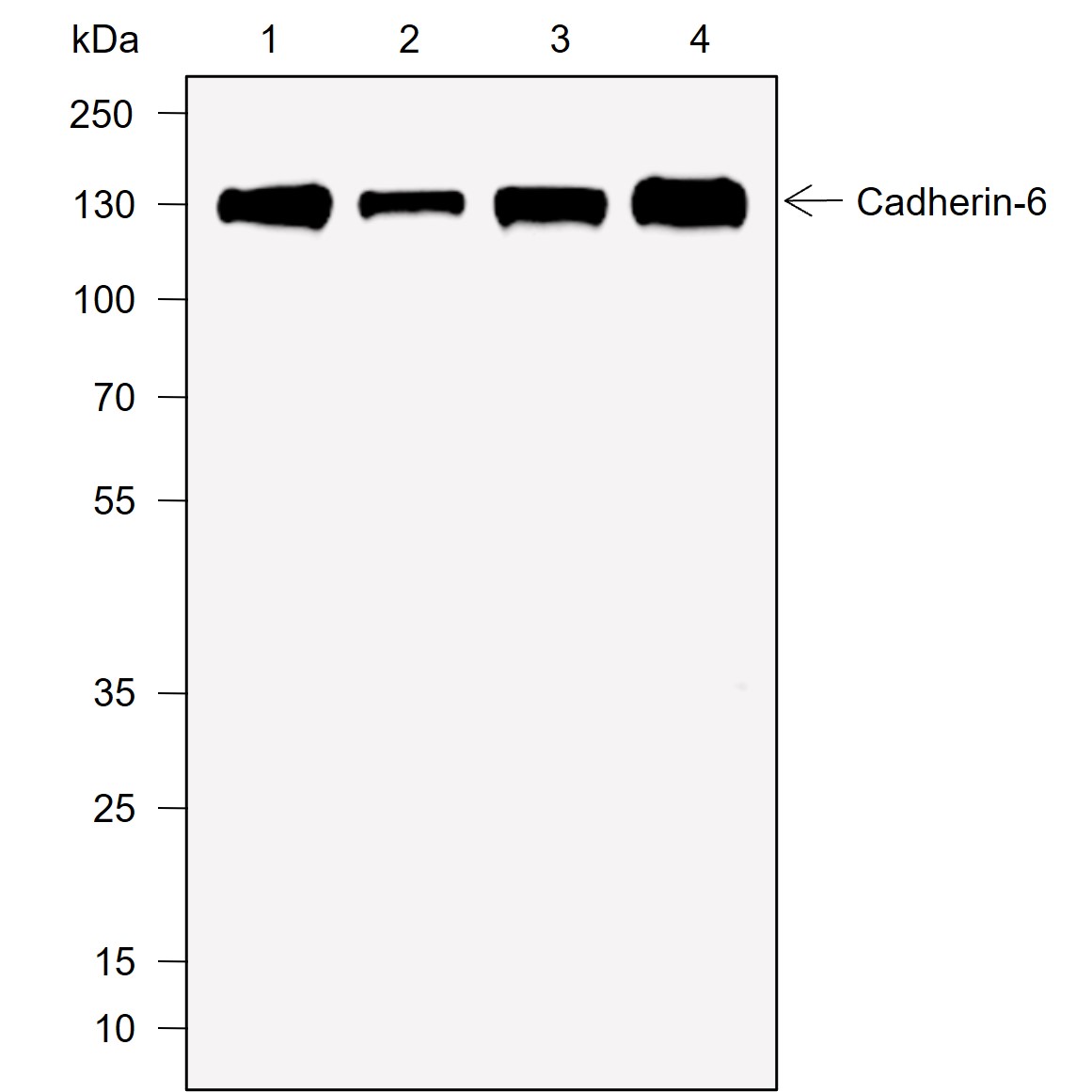 Anti-Cadherin-6 Rabbit mAb