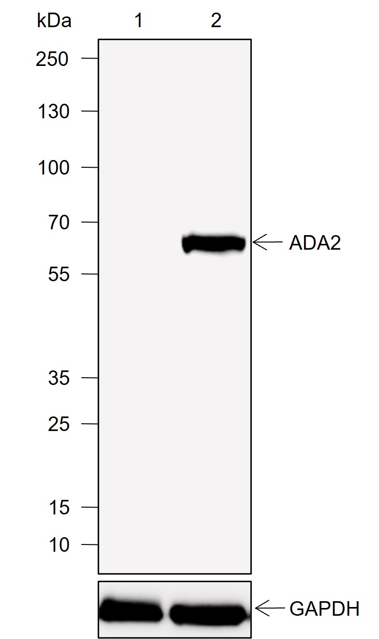 Anti-ADA2 Rabbit mAb