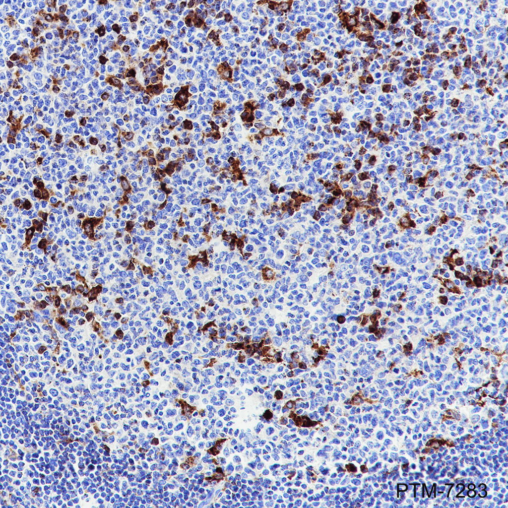 Anti-ADA2 Rabbit mAb