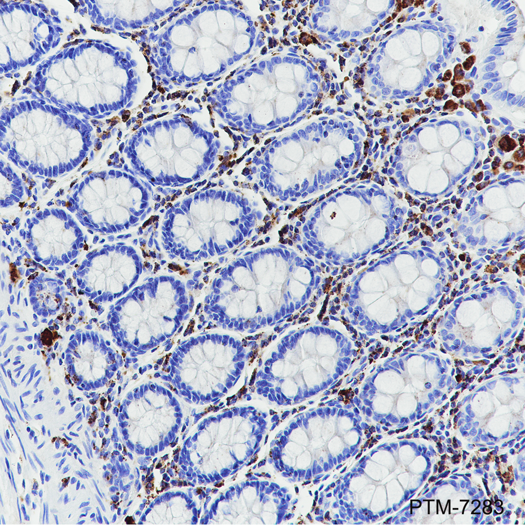 Anti-ADA2 Rabbit mAb