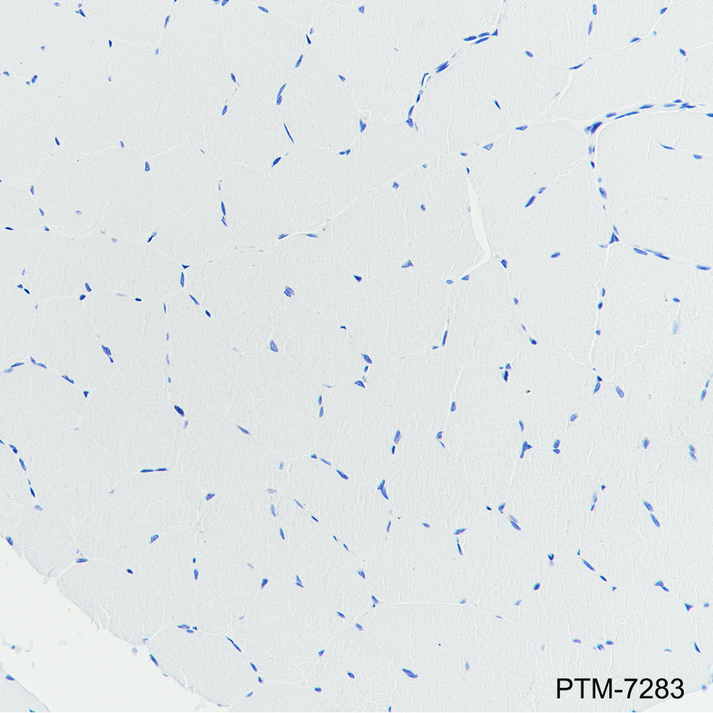 Anti-ADA2 Rabbit mAb