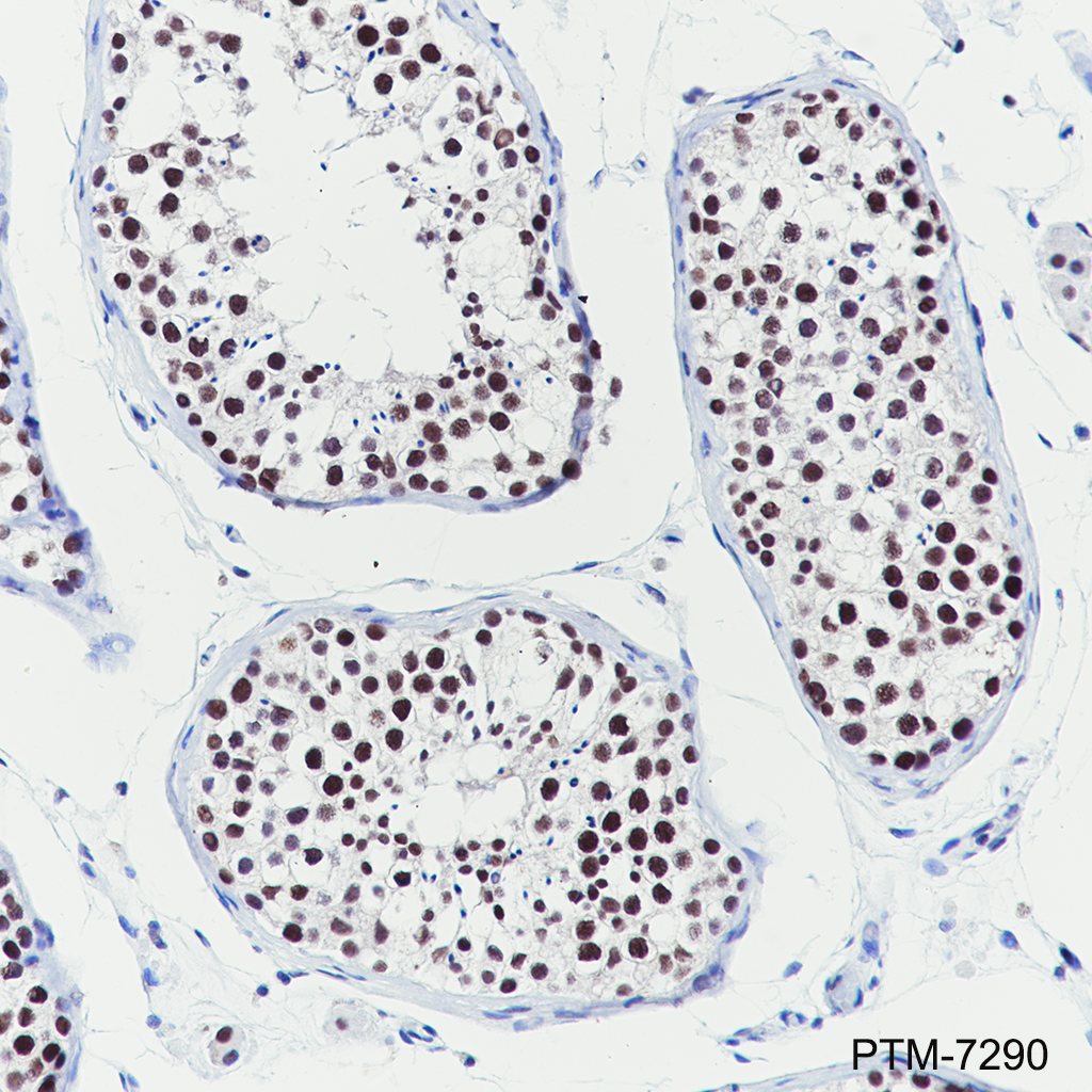 Anti-JMJD6 Mouse mAb