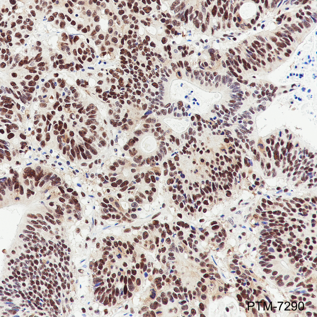 Anti-JMJD6 Mouse mAb