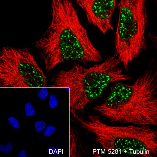 Anti-CBP Rabbit mAb