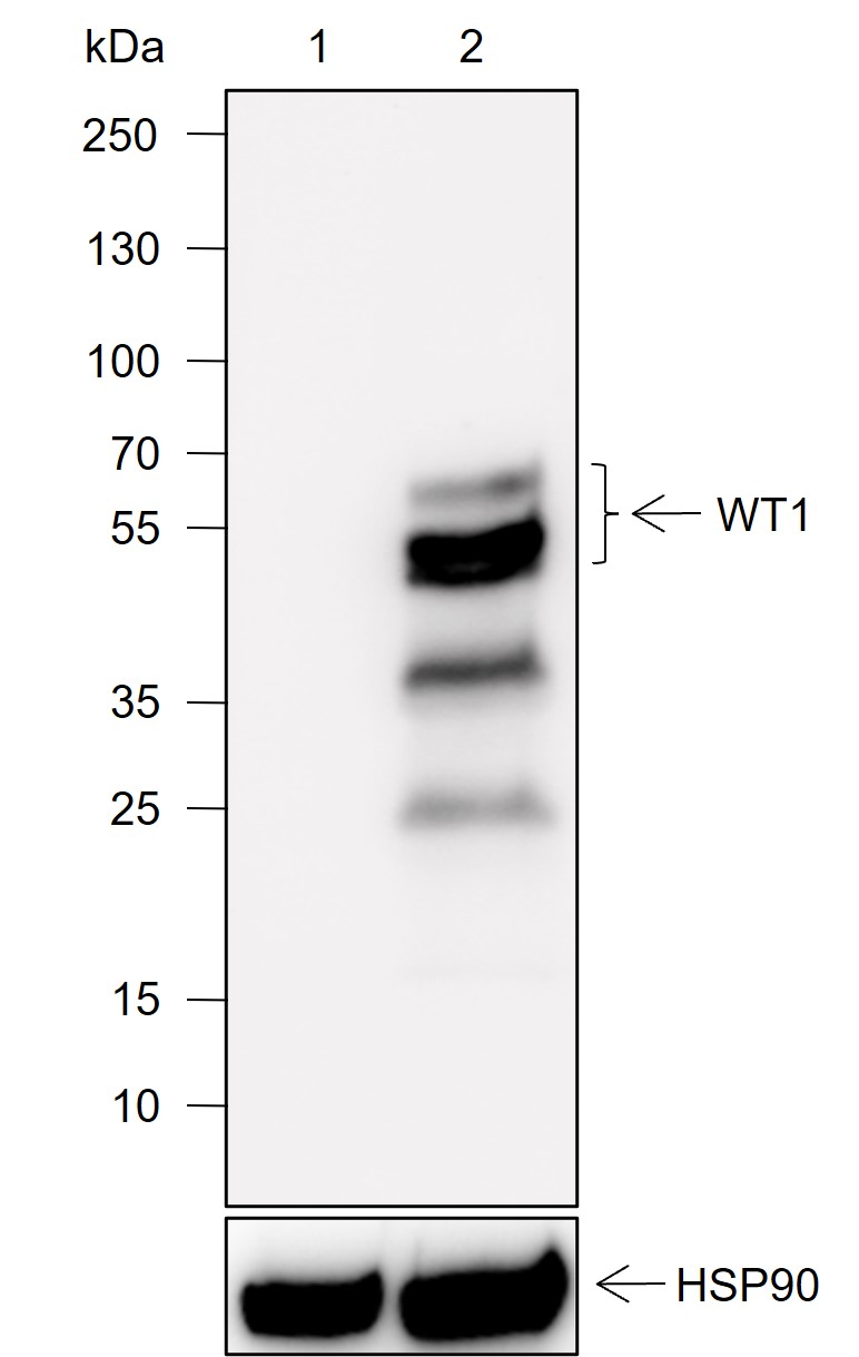 Anti-WT1 Rabbit mAb