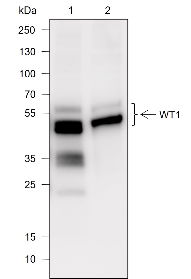 Anti-WT1 Rabbit mAb