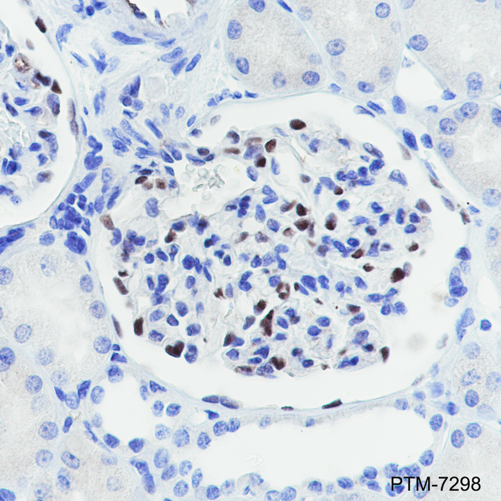 Anti-WT1 Rabbit mAb