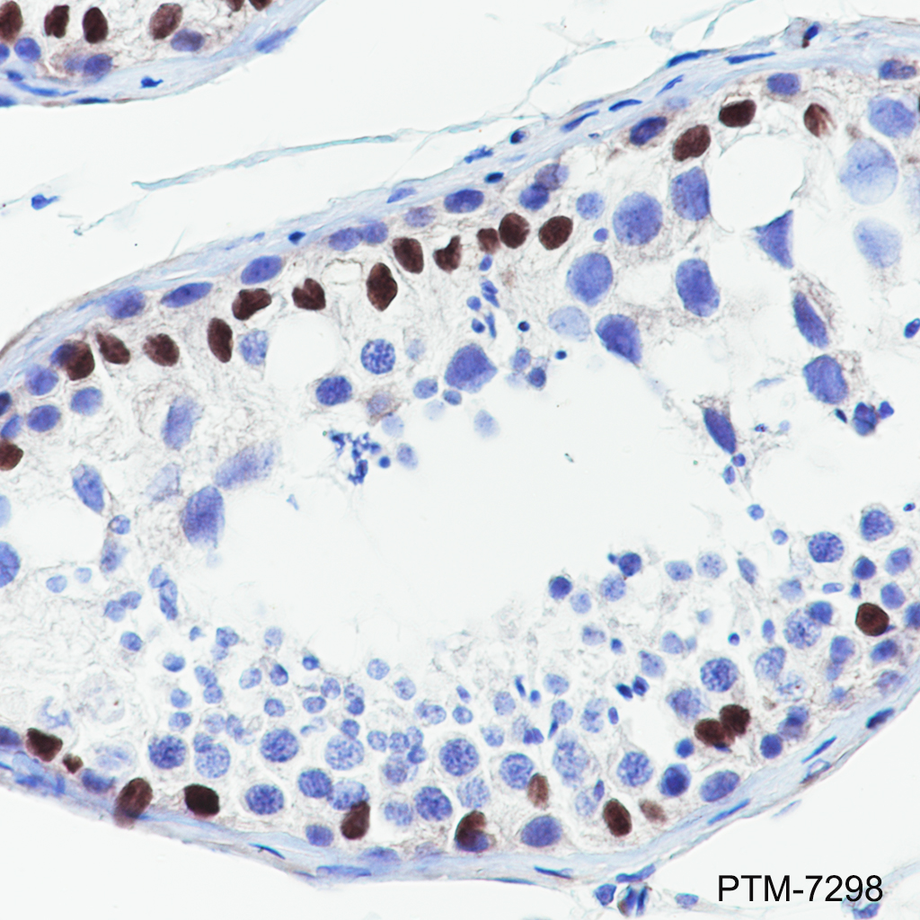 Anti-WT1 Rabbit mAb