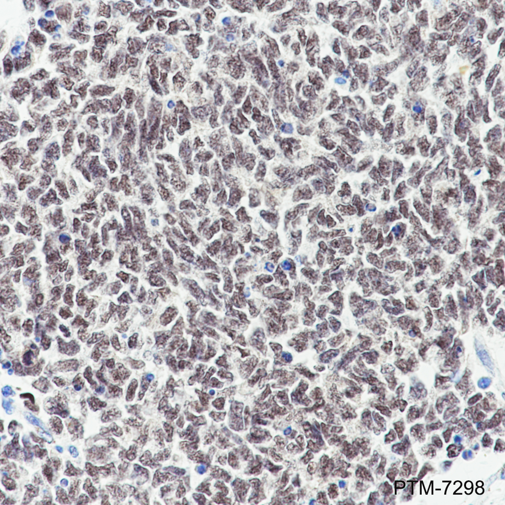 Anti-WT1 Rabbit mAb