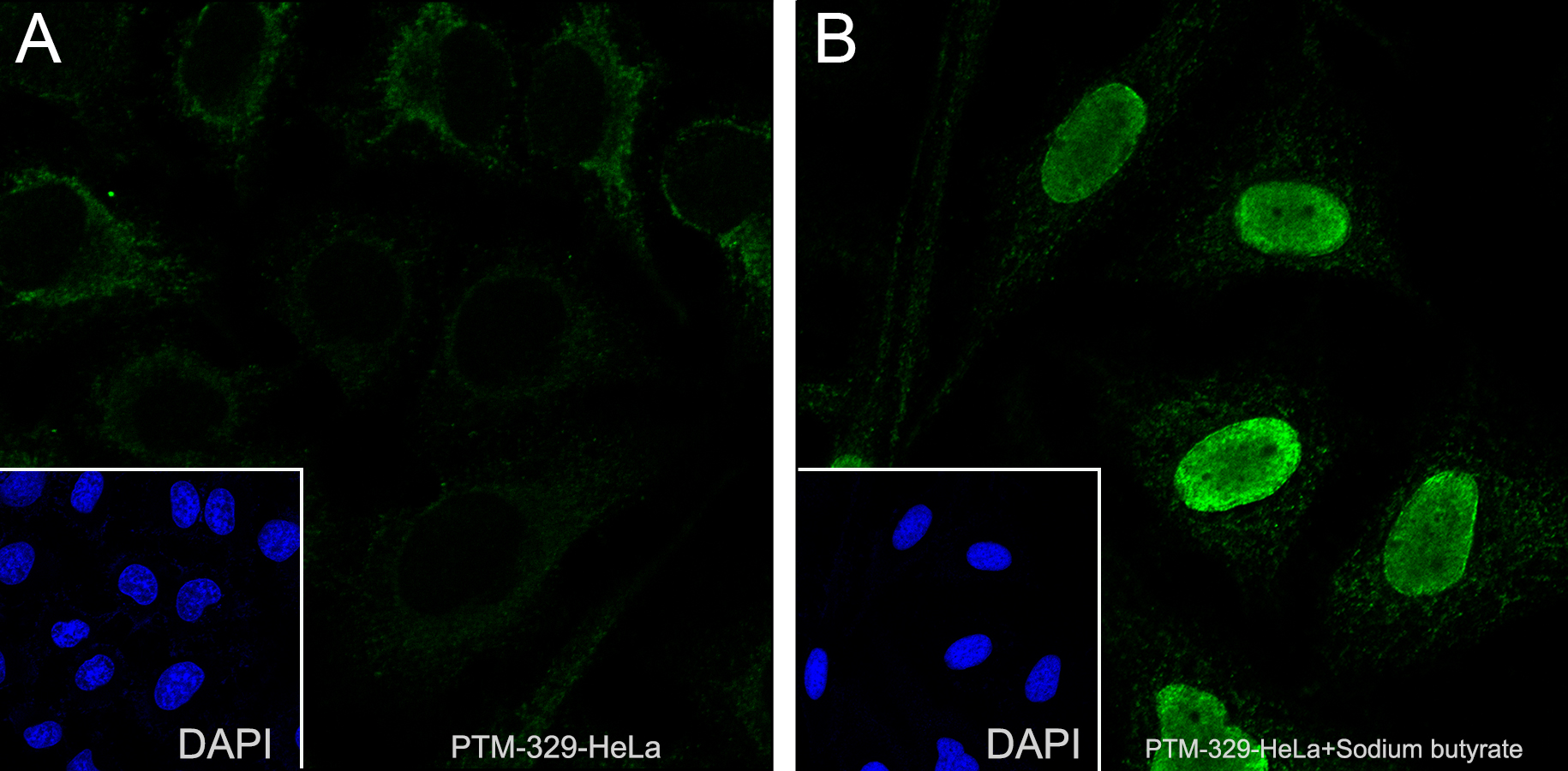 Anti-Butyryllysine Mouse mAb