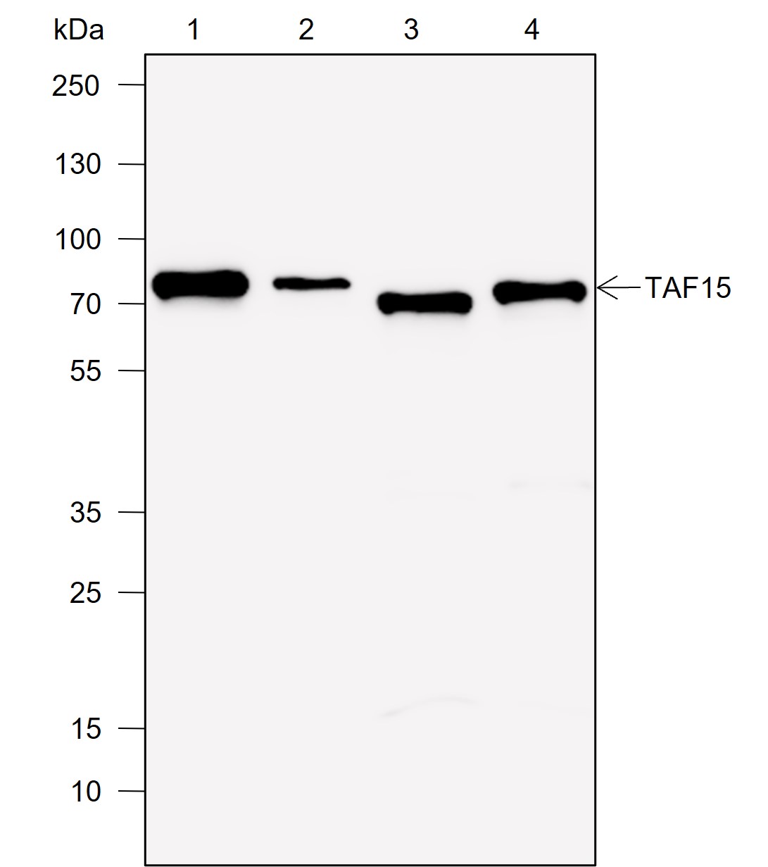 Anti-TAF15 Rabbit mAb