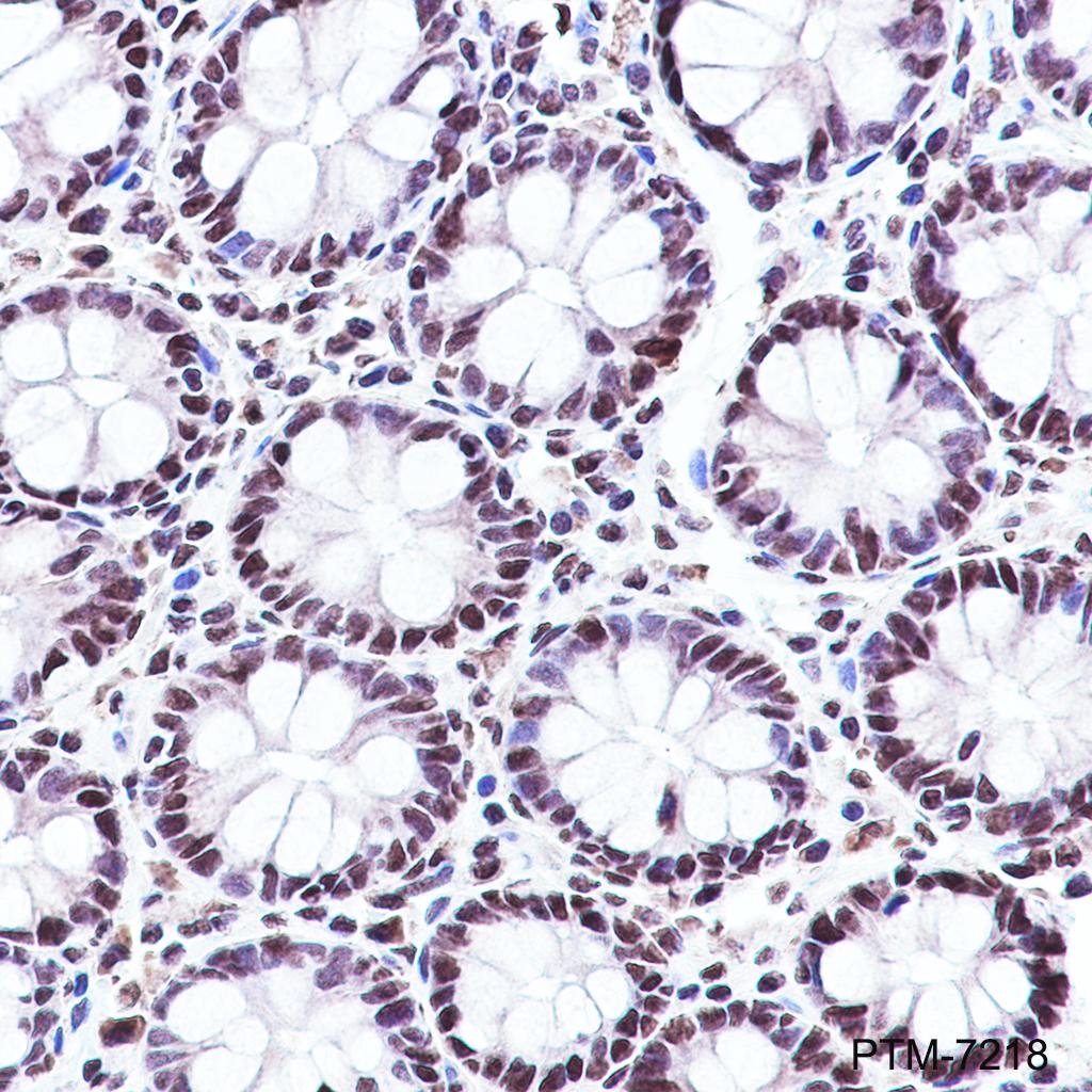 Anti-TAF15 Rabbit mAb