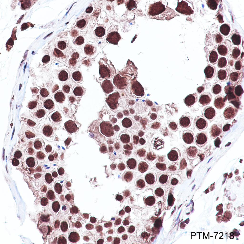 Anti-TAF15 Rabbit mAb