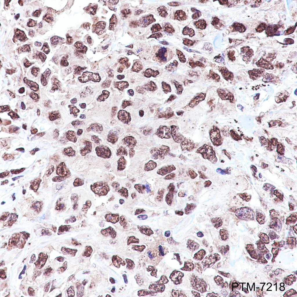 Anti-TAF15 Rabbit mAb