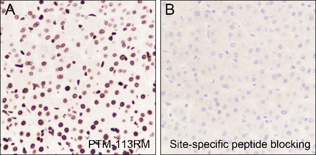 Anti-Acetyl-Histone H3 (Lys14) Rabbit mAb