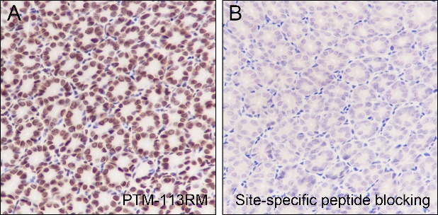 Anti-Acetyl-Histone H3 (Lys14) Rabbit mAb