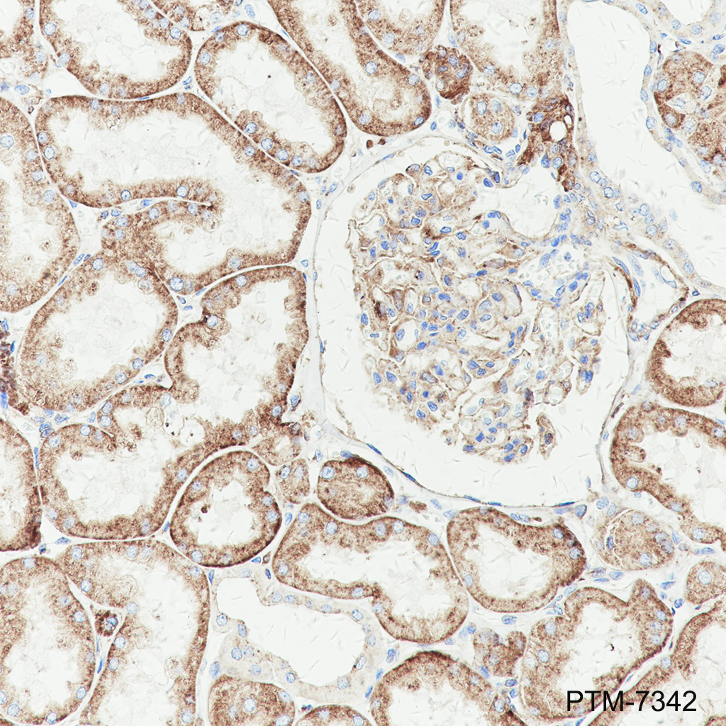 Anti-LAMP1 Rabbit mAb