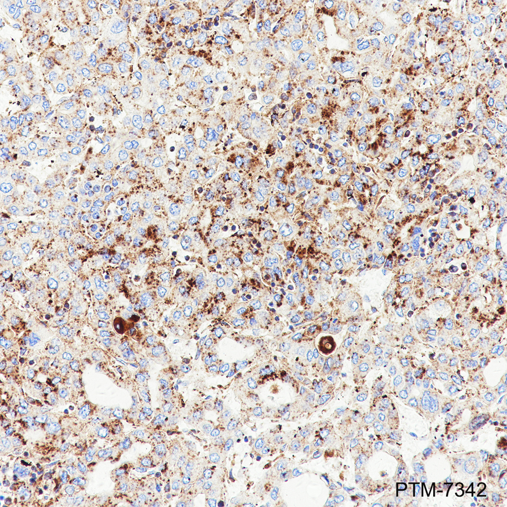 Anti-LAMP1 Rabbit mAb