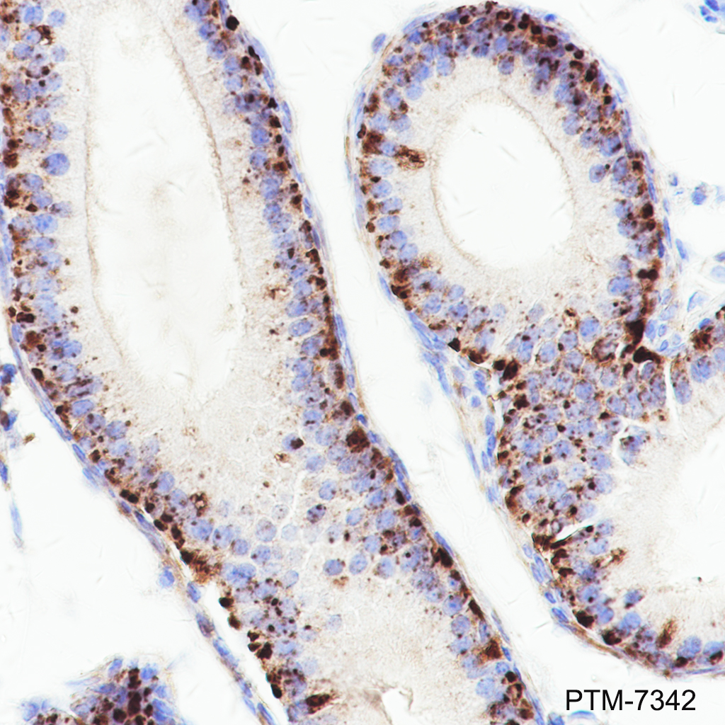 Anti-LAMP1 Rabbit mAb