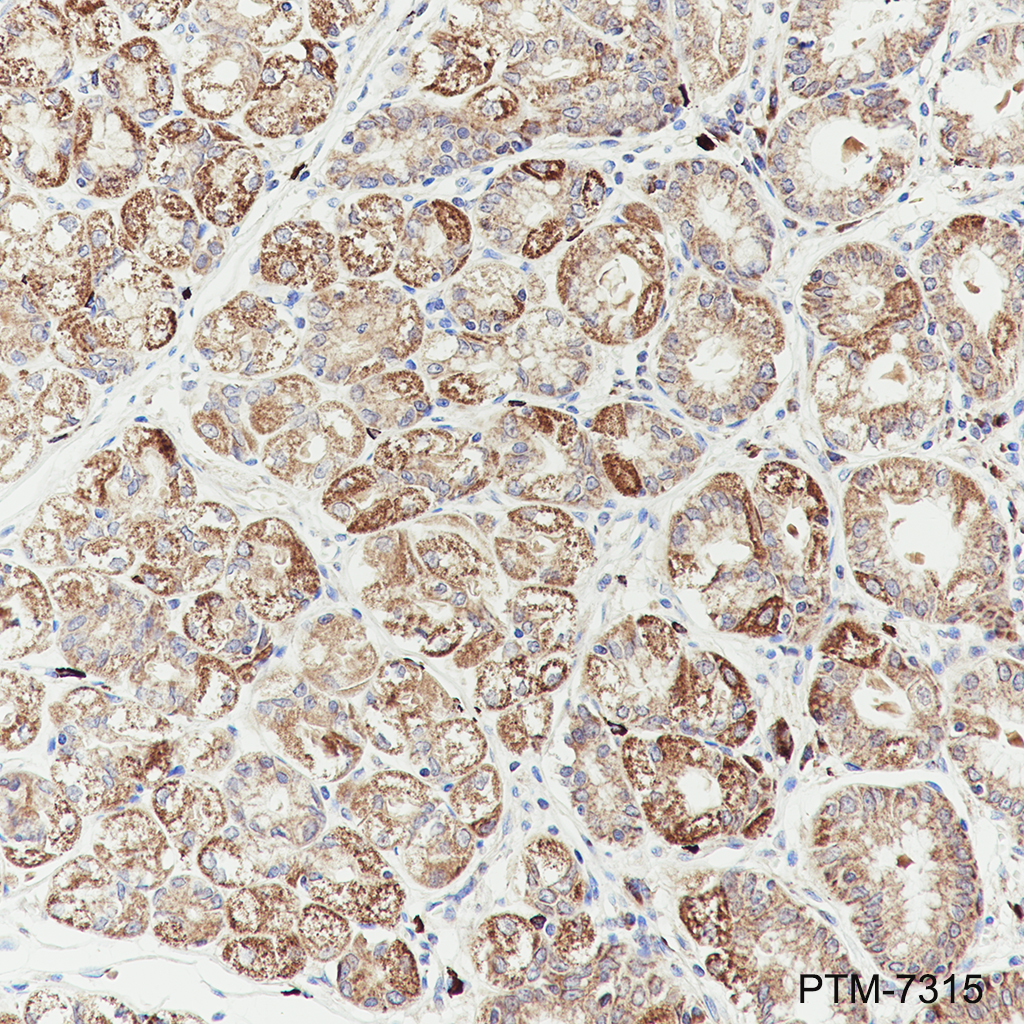 Anti-CCR10 Mouse mAb