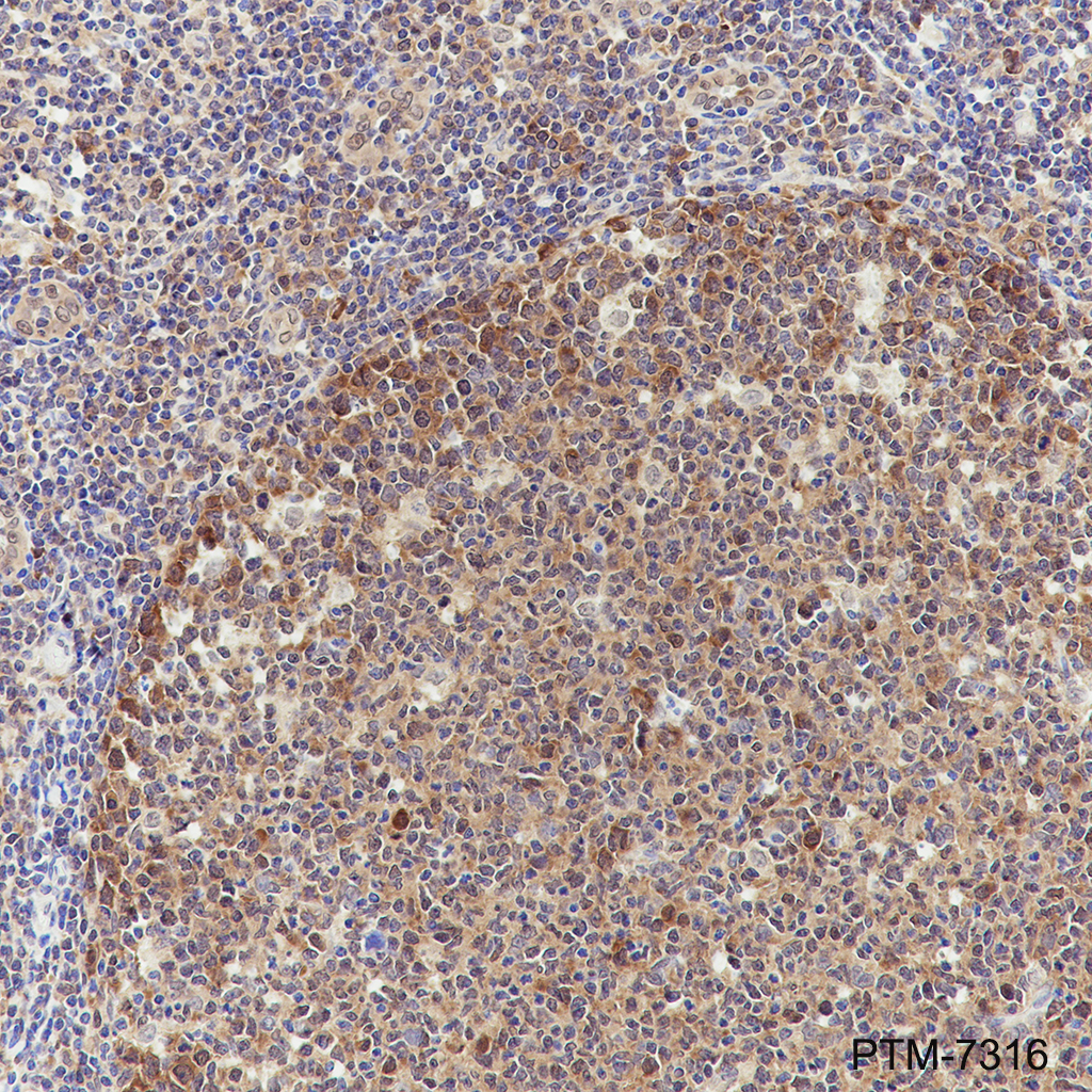 Anti-MEP50 Mouse mAb