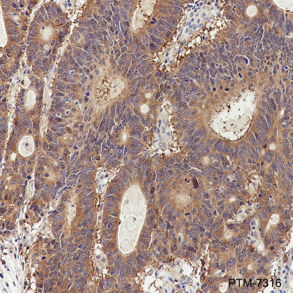Anti-MEP50 Mouse mAb