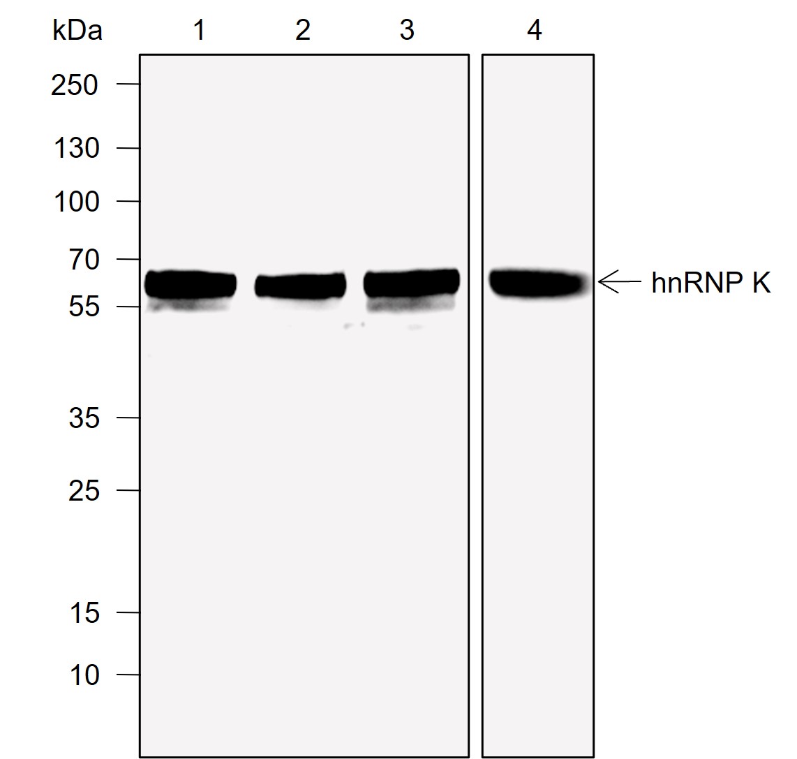 Anti-hnRNP K Mouse mAb