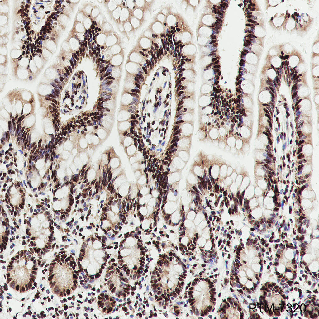 Anti-hnRNP K Mouse mAb