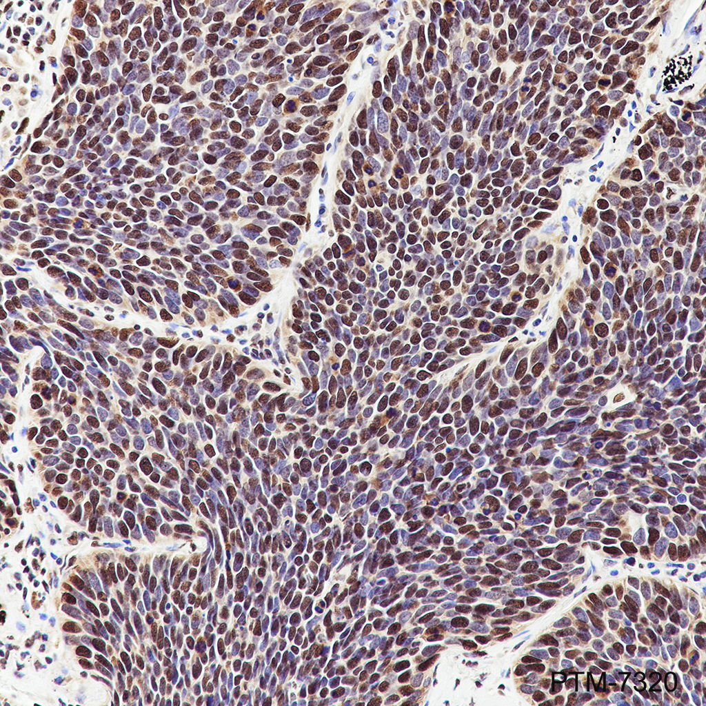Anti-hnRNP K Mouse mAb